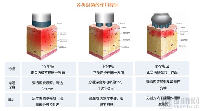 国货创新力量崛起 医美能量源设备领域即将大爆发